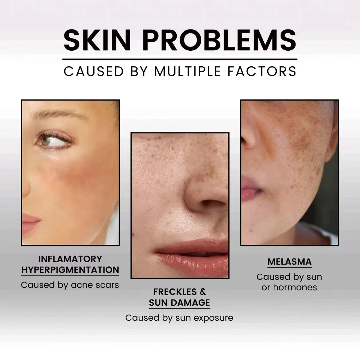 New 100% Pure Organic Natural Vitamin E Oil Face Body Massage Spa Avocado Essential Oils Cold Pressed Moisturiser Serum